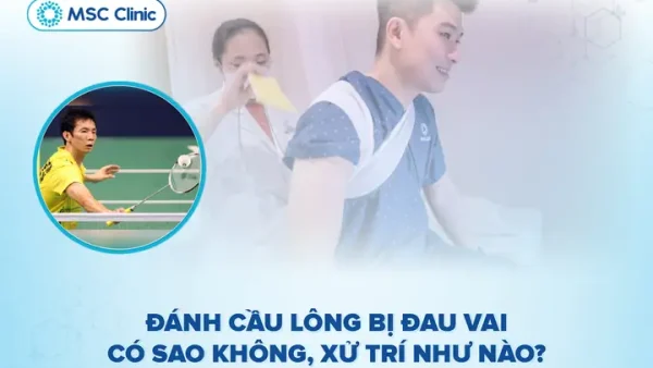 Đánh Cầu Lông Bị Đau Vai: Nguyên Nhân, Cách Xử Lý Và Phòng Ngừa Hiệu Quả
